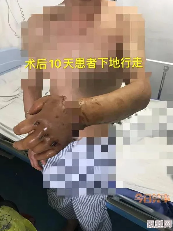 真实记录3分19秒砍断手断脚视频为什么引发人们对真相的探寻和反思